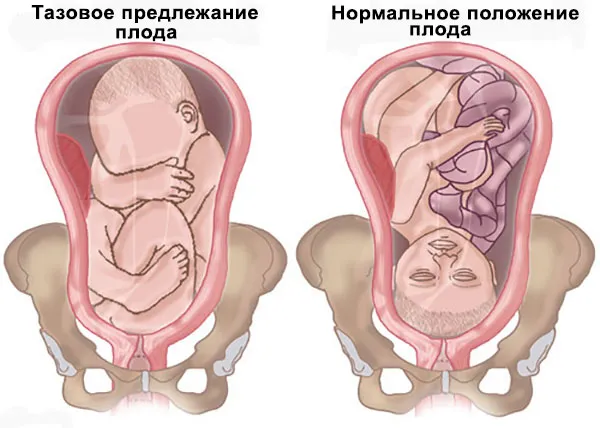 Беременность 38 недель