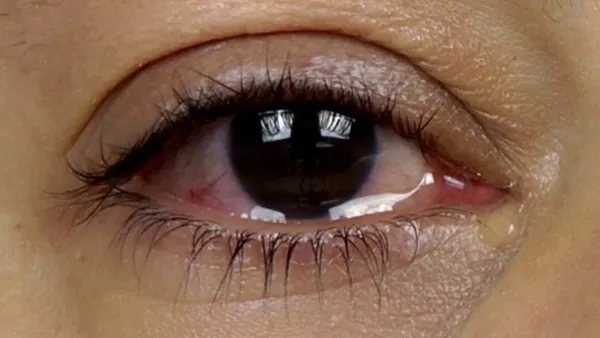 Как сделать красные глаза в домашних условиях
